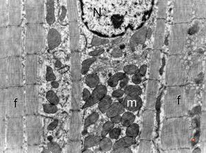 normal cardiomyocyte … longitudinal section(N - nucleus, m … mitochondria, f - myofilaments) normal cardiomyocyte … longitudinal section(N - nucleus, m … mitochondria, f - myofilaments)
